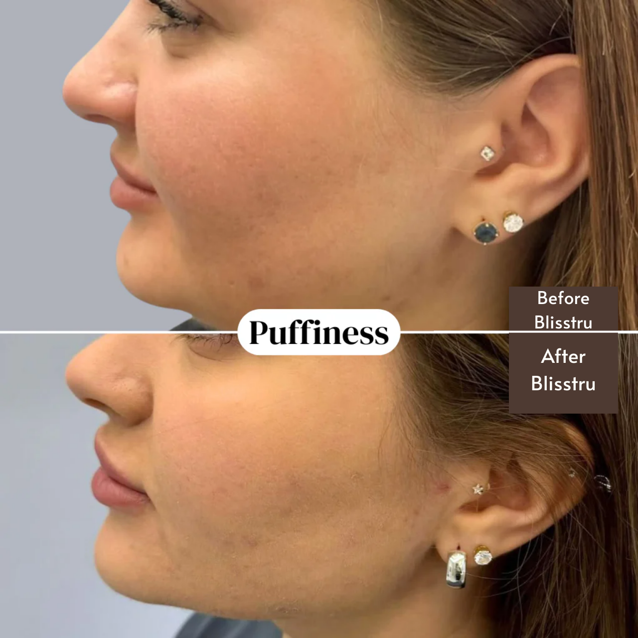 Organic Lymphatic Drainage Drops-100% Natural & Toxin-Free