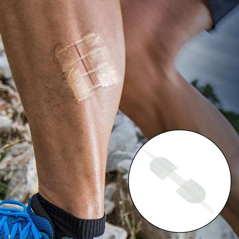 Wound Closure Kit – 2 Pcs, Suture-Free Strips