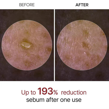 SilkGlow Rice Ampoule Exfoliant Set (both bottles)