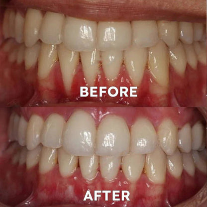 Ourlyard™ Tooth Powder